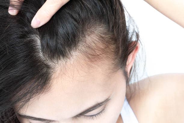 Postpartum Hair Loss vs. Other Hair Loss: What's Normal, What's Not, and How to Regrow - Featured health article